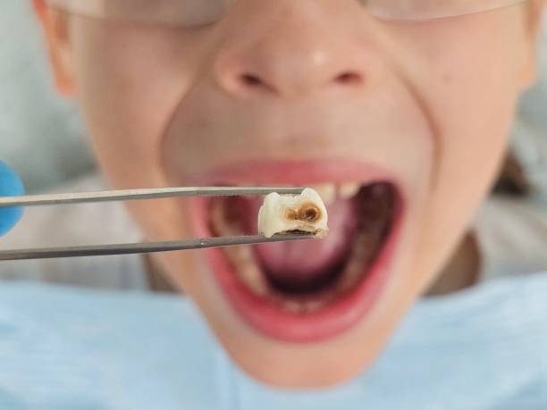 Best Chipped Tooth Repair Near Me  in Malta, IL